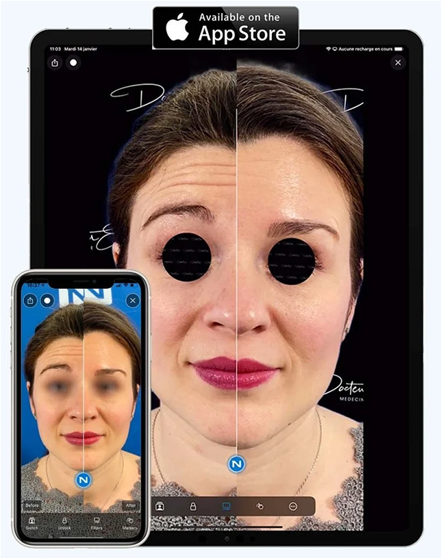Nextmotion Capture App Screenshot