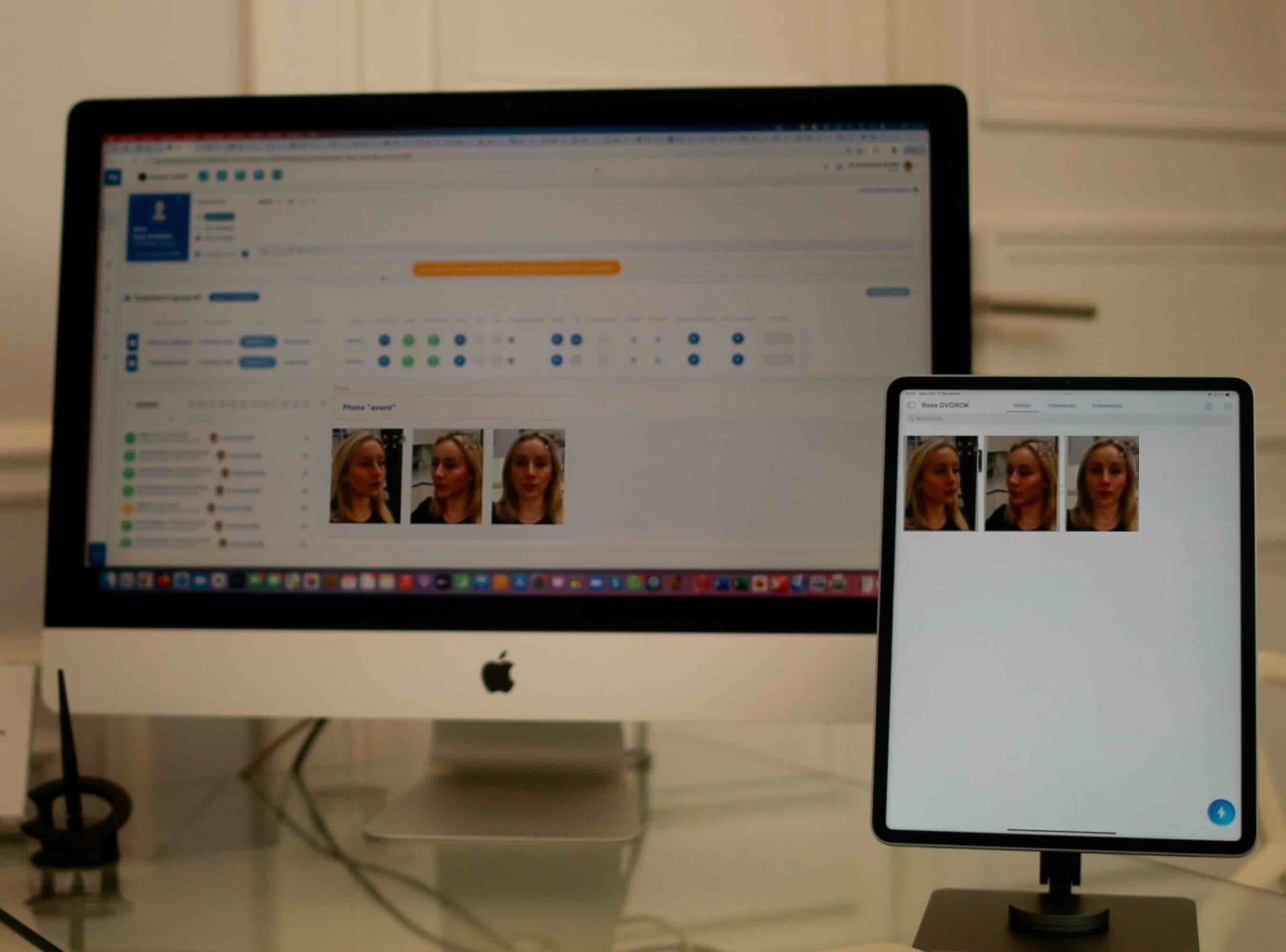 Affichage des photos avant/après synchronisées sur un ordinateur et un iPad grâce à l'application NM Capture, offrant un accès facile et une organisation optimale des dossiers patients