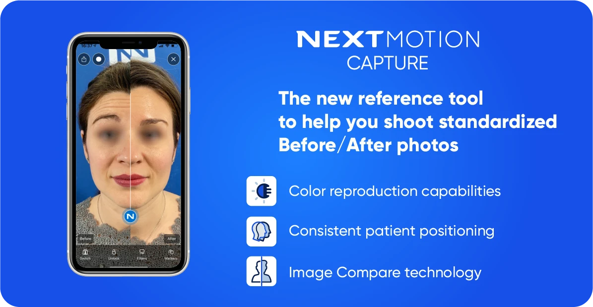 NM_Capture_EN