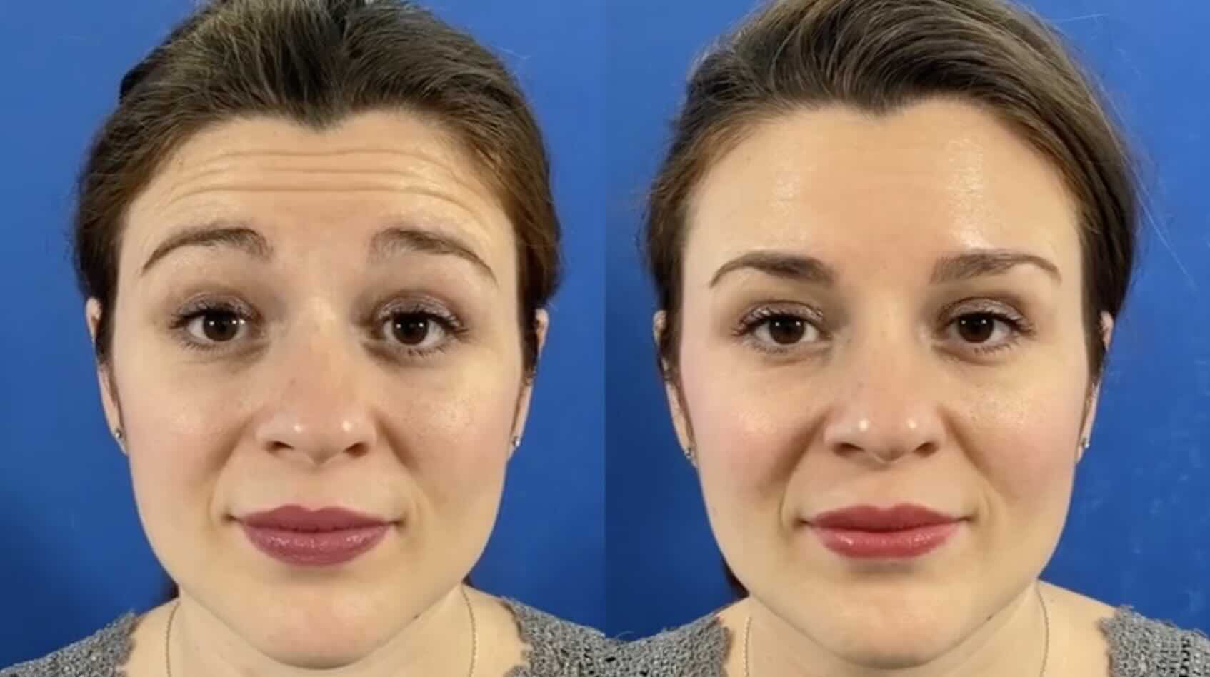 Nextmotion Revolution - Vue 2