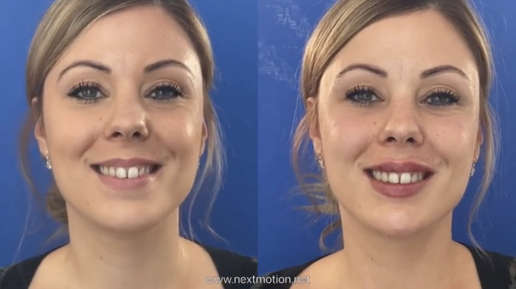 Nextmotion Revolution - Vue 4